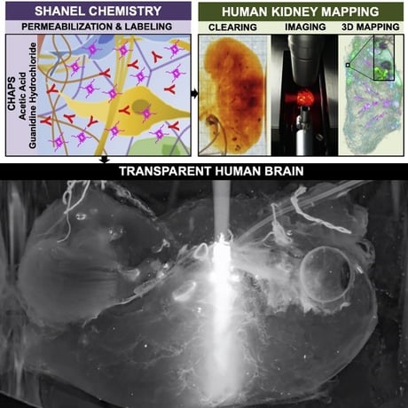 Transparent Human Brain